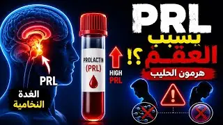 E2. Prolactin (PRL) Horomne هرمون الحليب البرولاكتين