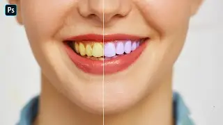 Whitening Yellow Teeth Simplest and Quick way in Photoshop || quick guideline in photoshop cc