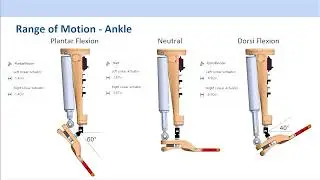 Biomechatronic Foot | Project Showcase 2023