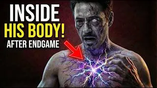 What Did They Find Inside Tony Stark After Endgame?