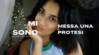HO MESSO UNA PROTESI