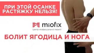 Боль в Бедре и ягодице  Миопрессура лечение