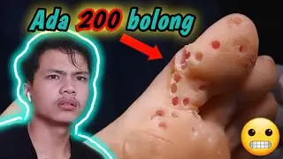 KAKINYA KOK BERLOBANG BANYAK BEGINI😬