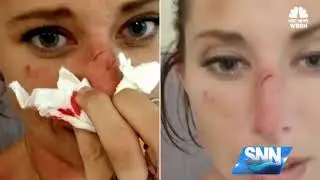 SNN: Pet iguana goes bad