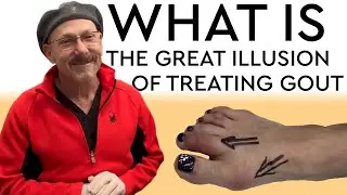 The Great Illusion of Gout