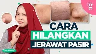Cara Hilangkan Jerawat Pasir Untuk Remaja
