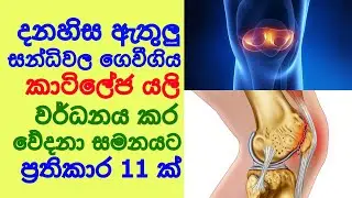 දණහිස් වේදනා නැතිකර ගෙවීගිය කාටිලේජ වර්ධනය කරන ප්රතිකාර 11ක් Remedies for knee pain - Sonduru Diviya