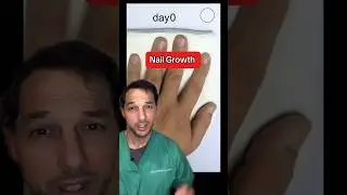 Nails grow about 3.5 mm per month 