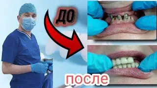 КЕРАМИКА ТИШ КУЙИШНИ ХОХЛАЙСИЗМИ , СРОЧНО КУРИНГ ! 