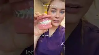 #doctor #nyc #braces #braces #invisalign #shorts