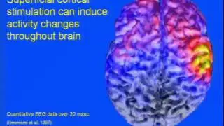 Transcranial Magnetic Stimulation in Psychiatry: Current Status and Future Directions