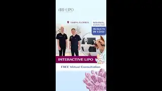 Interactive Liposuction | Artlipo | Experts Dr. Thomas Su and Dr. George Kardashian