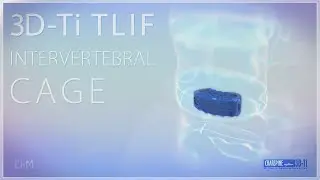 TLIF INTERVERTEBRAL CAGES