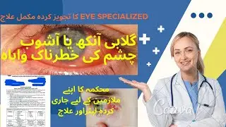 Pink Eyes Ya Ashob e Chasham Ka Elaj kaise kre | How To Get Rid of Pink Eye #pinkeye #adenovirus