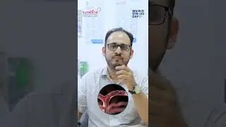 World Stroke Day| dr siddesh rajadhyax