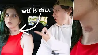 I Got A Real Hickey To Prank My Boyfriend