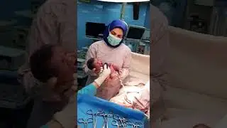 baby birth cesarian