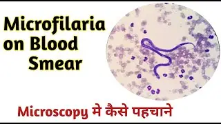 Microfilaria under microscope