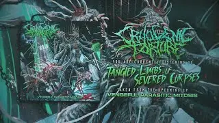 CRYOGENIC TORTURE - TANGLED LIMBS OF SEVERED CORPSES  [OFFICIAL VISUALIZER] (2024) SW EXCLUSIVE