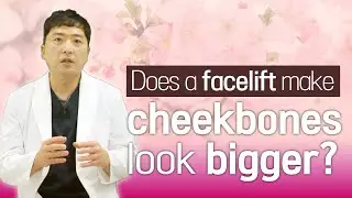 Does a facelift make the cheekbones look bigger?