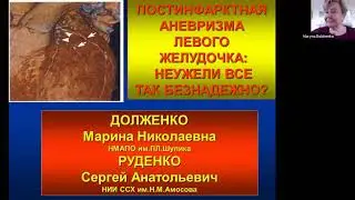 Постинфарктные аневризмы