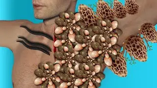 ASMR Remove Maggots & Worm Infected Armpit | Severely Injured Animation