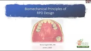 Biomechanical Principles of Removable Partial Denture Design- Dr Berna Saglik