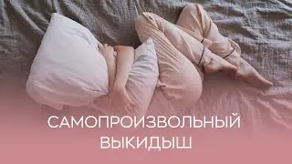​🙋‍♀️ Чем опасен самопроизвольный выкидыш?