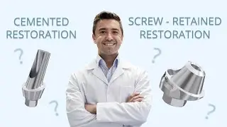 Cemented restoration vs Screw Retained restoration in lack of space.🦷 Dental materials