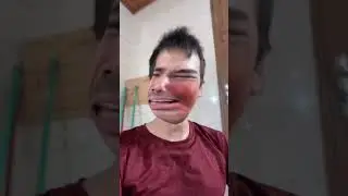 SE OS FILTROS FOSSEM NO MÉDICO (parte 4) 😂