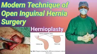 Inguinal Hernia Repair | Hernioplasty live surgery