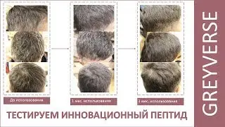 Тестируем инновационный пептид от седины - Грейверс (Greyverse)! Наши результаты