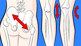 How to fix functional scoliosis naturally in 4 minutes a day