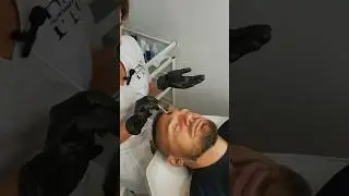 Чистка лица для мужчины 🤩 это афигенная процедура которую так любят мужчины 😎 #видеоролик #reels
