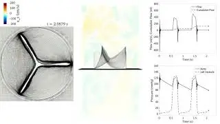 M1 Aortic valve simulation, physiological pressure slice view 10x slow motion