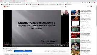 01042024- Бурцева Е.А. УЗИ у пациентов с аневризматической болезнью.