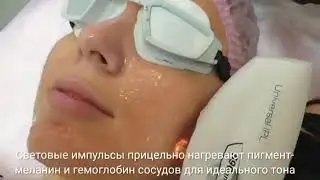 Фотоомоложение