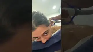 *LASER* HAIR REMOVAL PROCESS 😣😳 