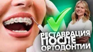 Почему после ортодонтии необходима эстетическая реставрация зубов?