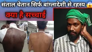 संताल कुड़ी जोलहा आर दिकु रे जावाय Mukesh Rdx सिर्फ बांग्लादेशी ही नहीं दिकू भी जल्दी देखे वीडियो