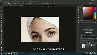 How to remove spots on a face using Photoshop - Easy steps in 2022