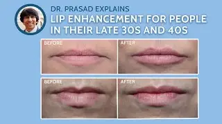How Lip Enhancement is Done for People in their Late 30s to 40s