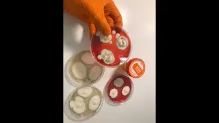 Методы экспресс-диагностики патогенных грибов (1я часть эфира)