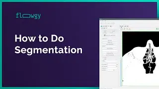 How to do Segmentation | Flowgy Academy