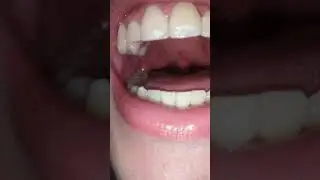 Playing with my prey | UVULA | MOUTH | VORE