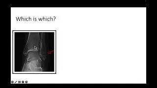 Ankle Anatomy Basics
