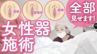 【小陰唇縮小術】施術全部見せます！女性器のお悩み解消！デリケートゾーンの施術！【VIO】