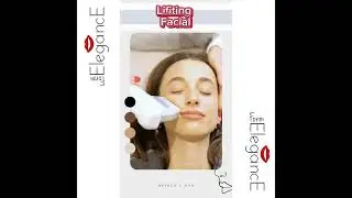 Cópia de Cópia de Cópia de Cópia de Cópia de Cópia de preenchimento facial   feminino