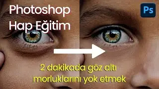 Photoshop – Hap Eğitim; 2 dakikada göz altı morluklarını yok etmek.