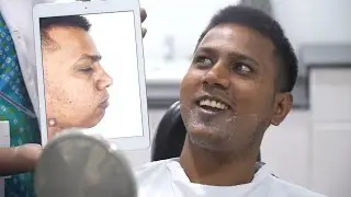 Indian Chin Surgery (Genioplasty) - Before & After Surgery Transformation